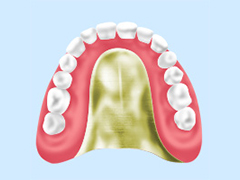 自費診療の入れ歯